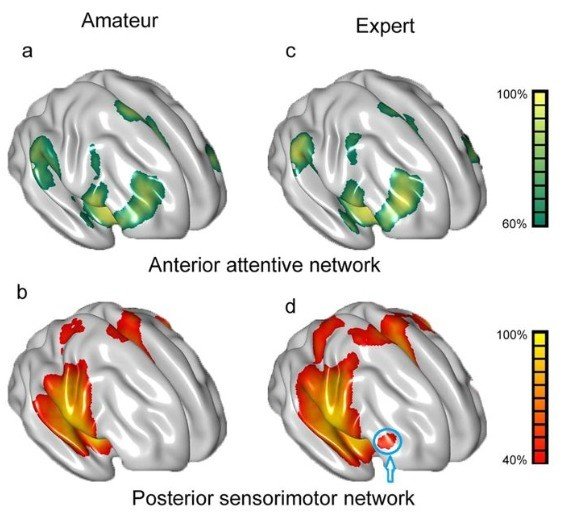 프로게이머와 일반인의 뇌 차이 / 출처: Scientific Reports에 게재된 연구서