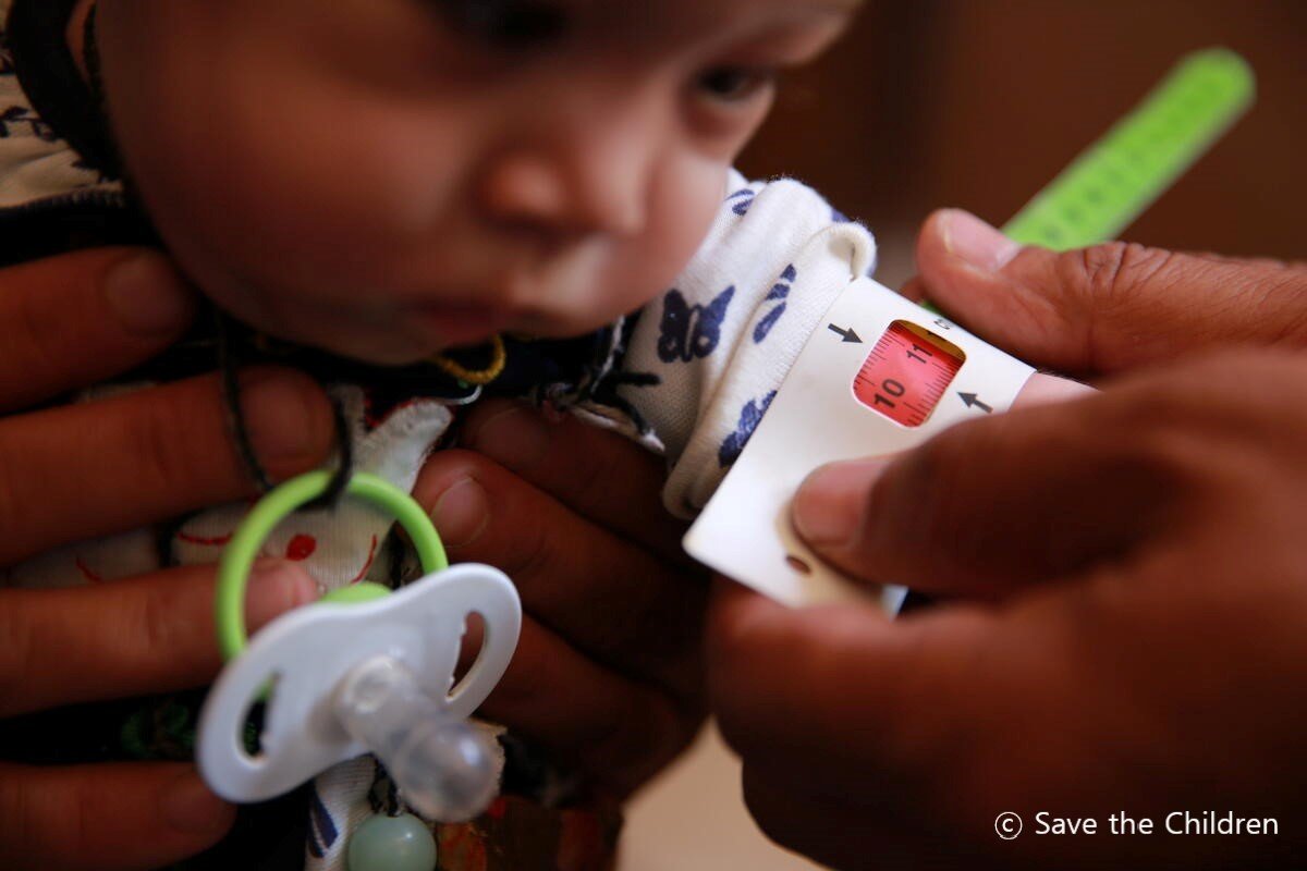 아프가니스탄 자우즈잔 지역의 가뭄과 빈곤 증가로 급성 중증 영양실조 진단을 받은 나디라(8개월·가명). 세이브더칠드런 제공