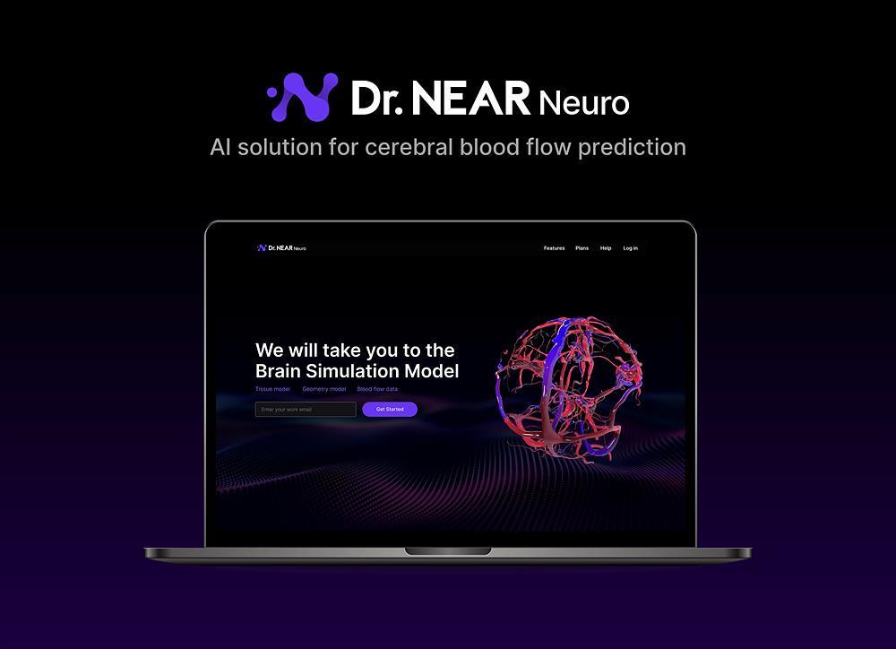 니어브레인의 뇌 3D 모델링 기술 ‘닥터 니어 뉴로’ / 출처=니어브레인