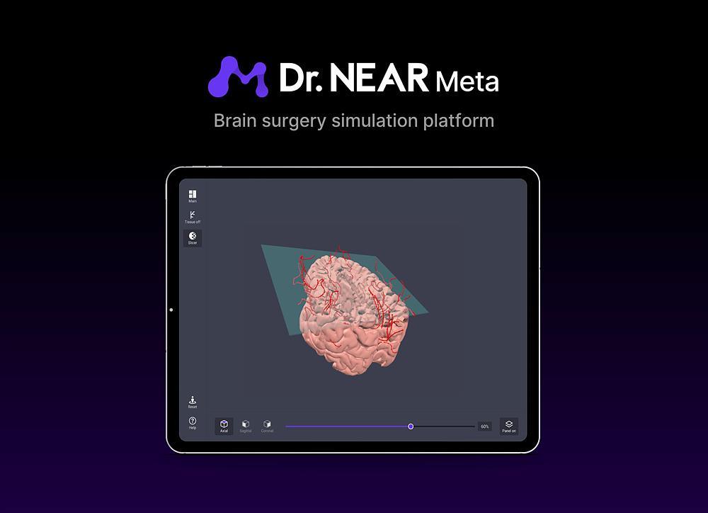 뇌 3D 모델링 기술을 메타버스 수술 실습 도구화한 ‘닥터 니어 메타’ / 출처=니어브레인