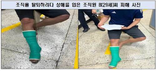 보이스피싱 조직을 탈퇴하려다 상해를 입은 조직원(제공=서울경찰청).뉴시스