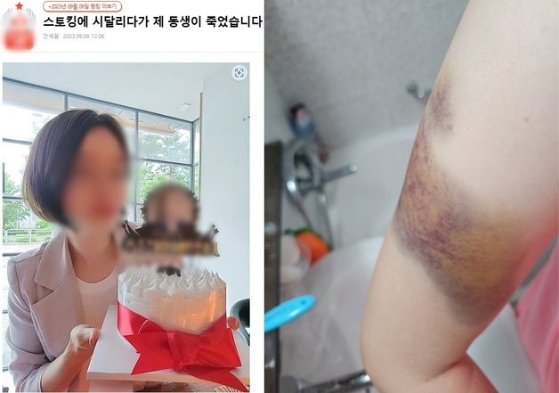 전 남자친구에게 스토킹 피해를 겪다가 스마트워치 반납 나흘만에 살해당한 피해 여성. 사진은 여성의 동생이 인터넷 커뮤니티에 가해자에 대한 엄벌을 촉구하면서 올린 여성의 사진과 가해자로부터 (언니가)폭행 피해를 당한 모습을 남긴 사진(인터넷 커뮤니티 캡처)2023.9.18/뉴스1 ⓒ News1