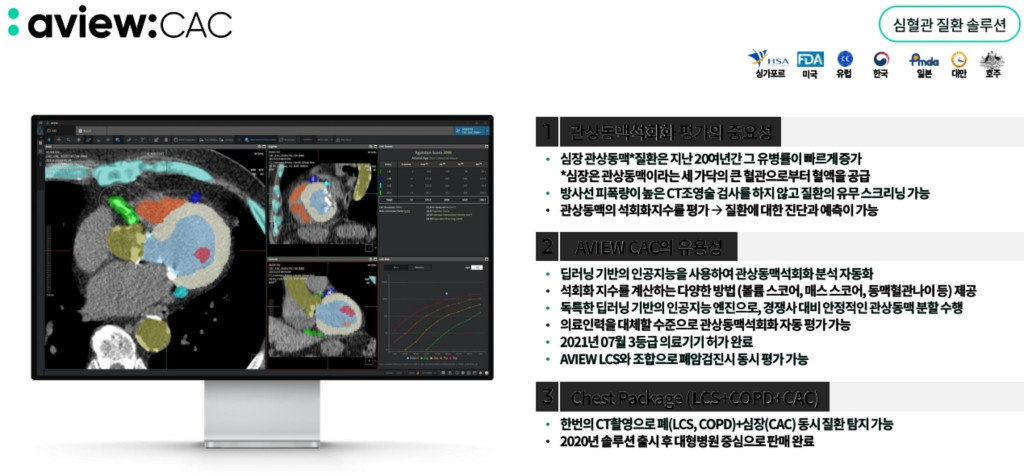 코어라인소프트의 심혈관 질환 솔루션, ‘AVIEW ACA’ / 출처=코어라인소프트