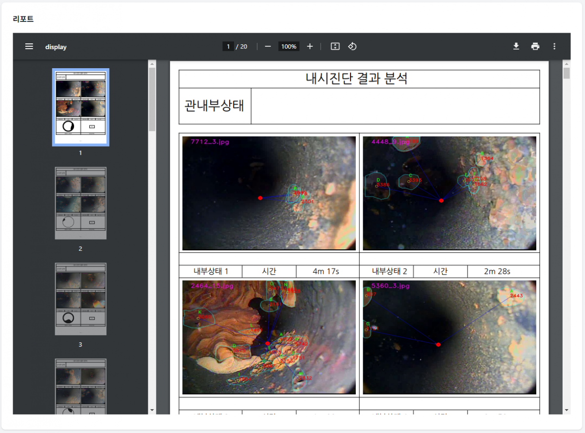 사용자가 내부 진단 영상을 올리면 AI 서버가 내부 진단 영상을 분석하고 스케일을 검출해 자동으로 결과 분석 리포트 화면을 생성한다. 인튜웍스 제공