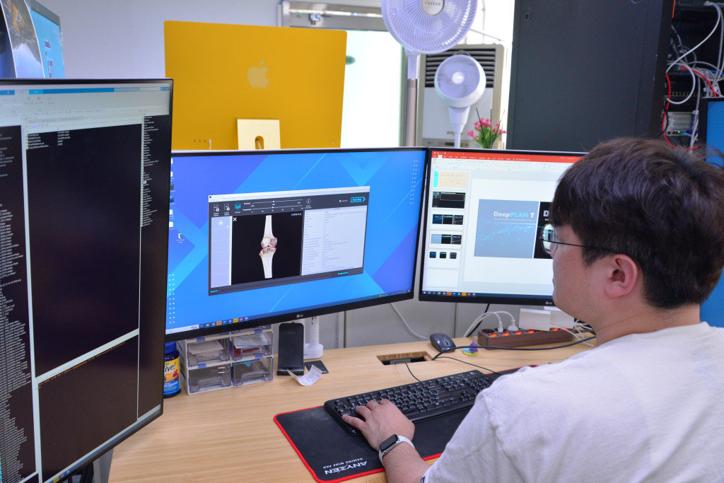 인공지능을 활용해 환자의 의료영상 정보를 분석, 3D 시뮬레이션으로 보여주고 있는 김무섭 카비랩 이사 / 출처=IT동아