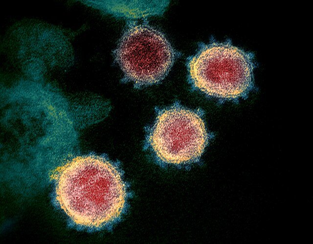 이브스케이프는 바이러스의 DNA 염기서열 정보를 학습해 변이 바이러스를 예측했다. 사진 출처 위키미디어