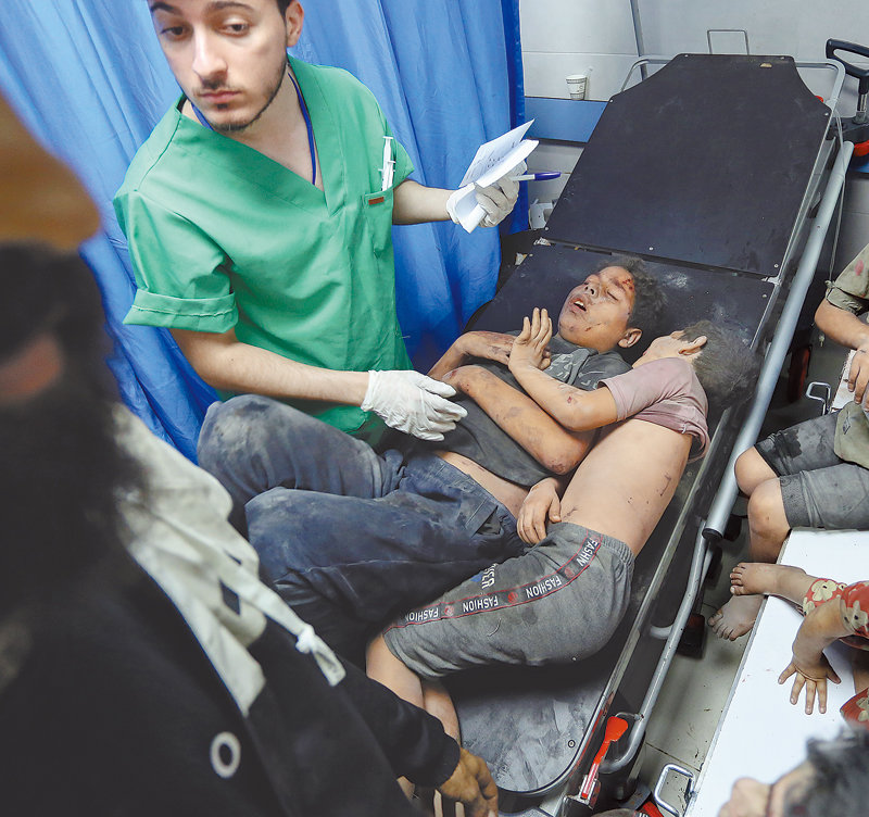 23일 가자지구 북부 가자시티에 있는 알시파 병원에서 이스라엘 공습으로 다친 팔레스타인 어린이들이 치료를 받고 있다. 가자시티=AP 뉴시스
