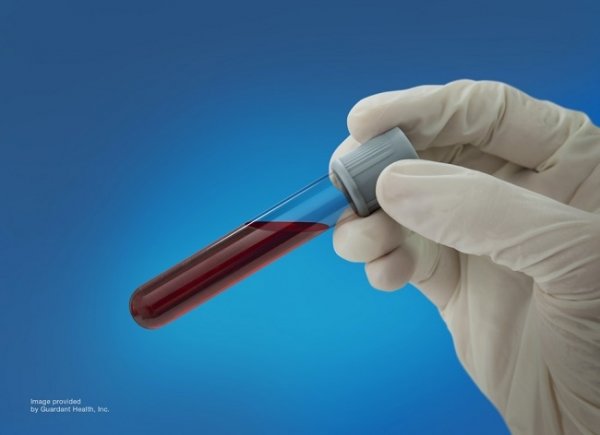 가던트헬스 혈액검사