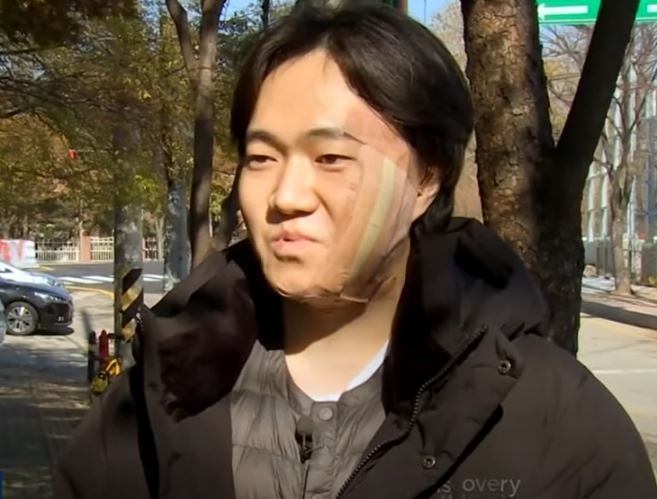 묻지마 폭행을 아버지와 같이 막은 이수연 씨. JTBC News 유튜브 캡처