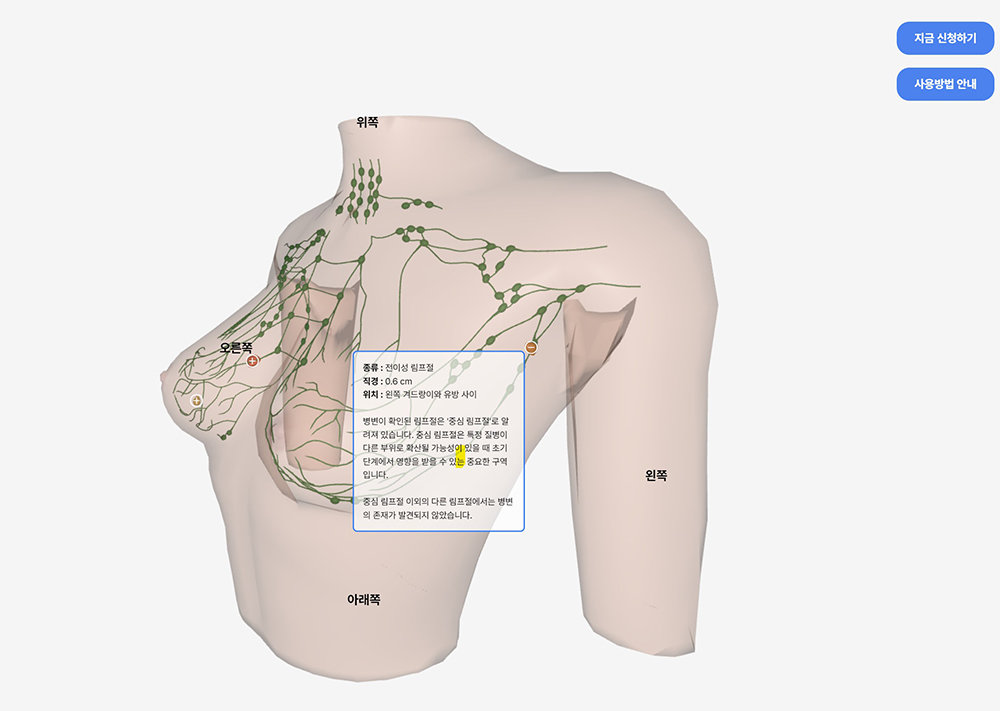 검사결과지를 3D 이미지로 시각화한 온톨 3D / 출처=테서