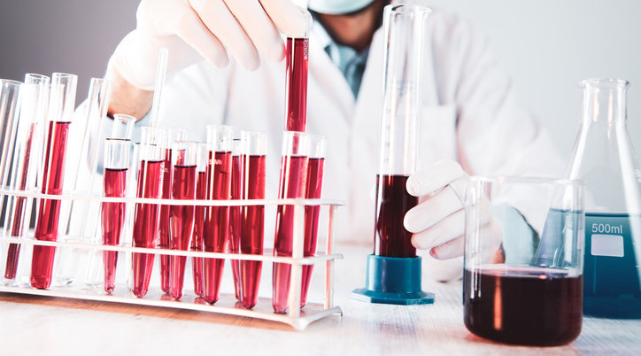 비침습적 방식인 혈액검사로 암 종양의 위치나 다양한 질병 정보를 알아낼 수 있는 것으로 나타났다. 혈액 샘플을 살피는 연구자의 모습. 게티이미지뱅크