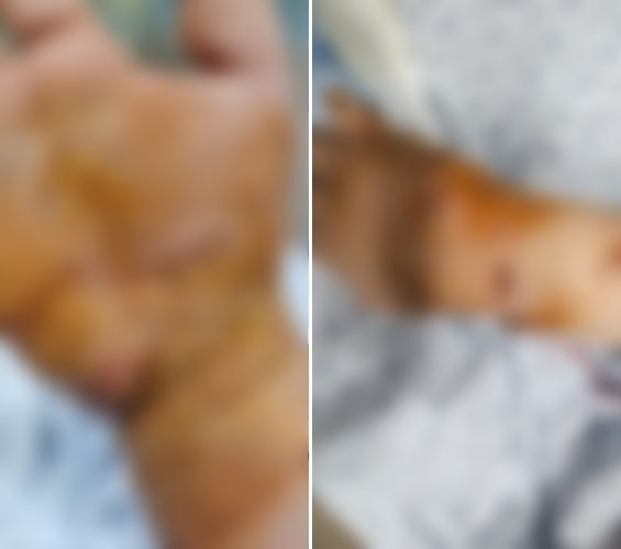 대리기사가 손님의 개에게 손을 물렸다며 공개한 사진. ‘보배드림’ 캡처
