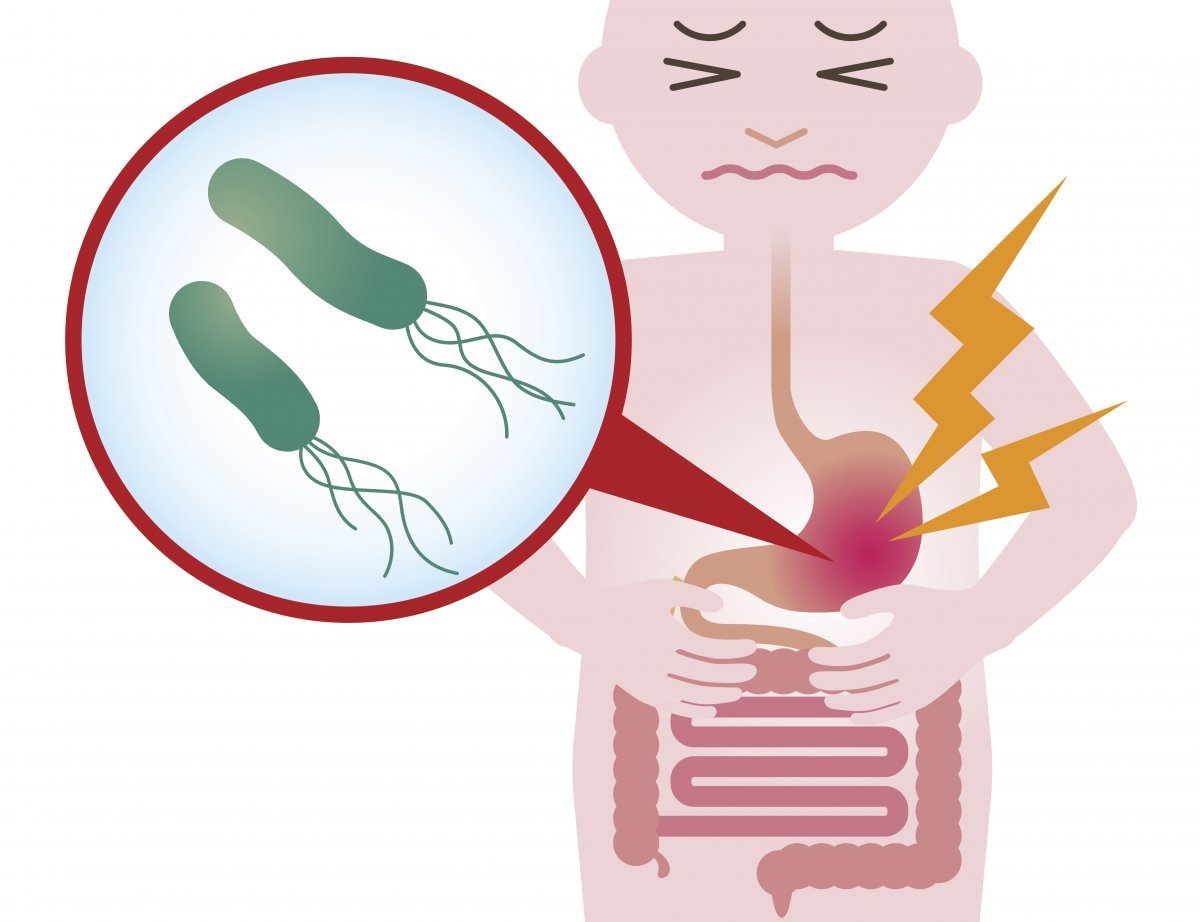 헬리코박터 파일로리. 게티이미지뱅크