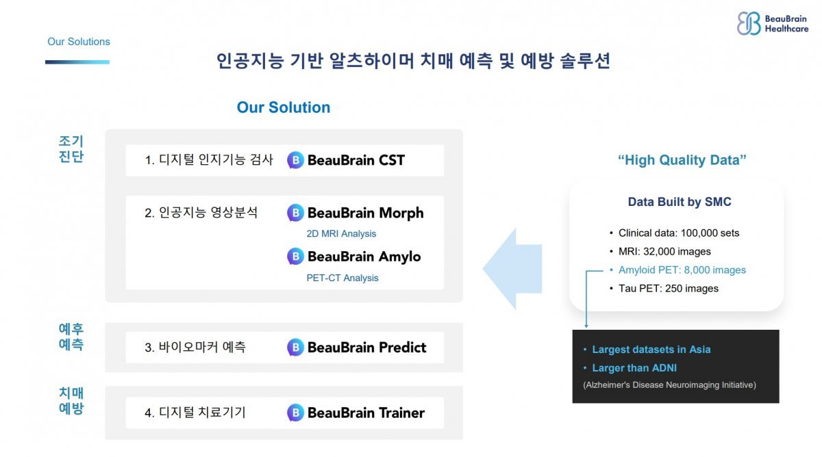 뷰브레인헬스케어는 치매 예측, 예방에 대한 솔루션을 착실히 준비하고 있다. / 출처=뷰브레인헬스케어