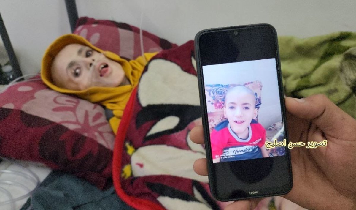 영양 실조 등에 시달리다 4일 숨진 팔레스타인 가자지구의 뇌성마비 소년 야잔 카파르네가 사망 전날인 3일 병원에 누워있는 모습. 출처 소셜미디어 ‘X(옛 트위터)’