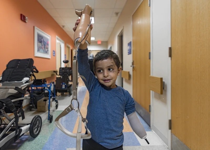 오마르가 지난달 미국 필라델피아 아동병원에서 의수를 들고 살짝 미소를 머금고 있다. 필라델피아=AP 뉴시스