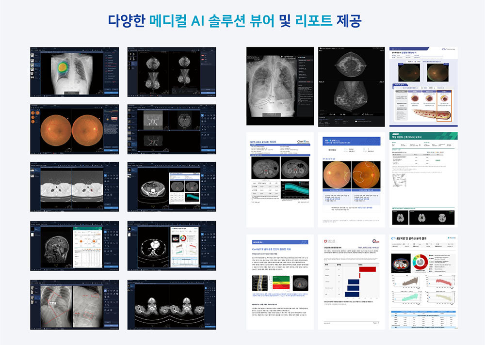 마이링크는 AI 진단 보조 솔루션 결과와 리포트를 함께 제공한다 / 출처=마이허브