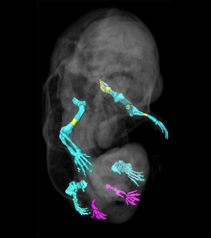 유전자 조작을 통해 다리가 6개인 쥐 배아의 골격을 3D로 재구성한 사진이다. 정상적인 배아의 경우 4개의 팔다리(푸 른색)가 생겨야 하지만 유전자 조작을 통해 생식기 대신 다리 2개(붉은색)가 더 생겨났다. 네이처 커뮤니케이션스 제공
