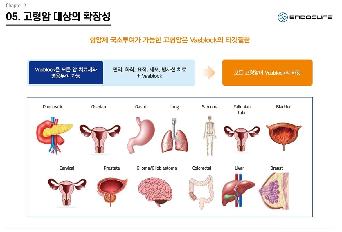 변실금 치료를 목적으로 연구했지만, 현재는 치료 영역을 확대하는 것이 목표다. / 출처=엔도큐라