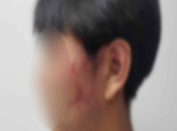 지난 8일 오후 8시경 전북 순창군 순창읍 한 상가 건물 옥상에서 고등학교 선배에게 폭행당한 학생의 모습. 전주MBC 방송화면 캡처