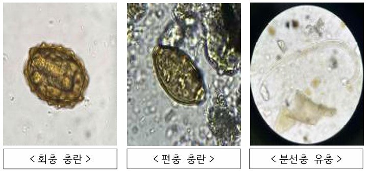 오물 내 포함된 토양에서는 회충, 편충, 분선충 등 기생충이 다수 발견됐다. 통일부 제공