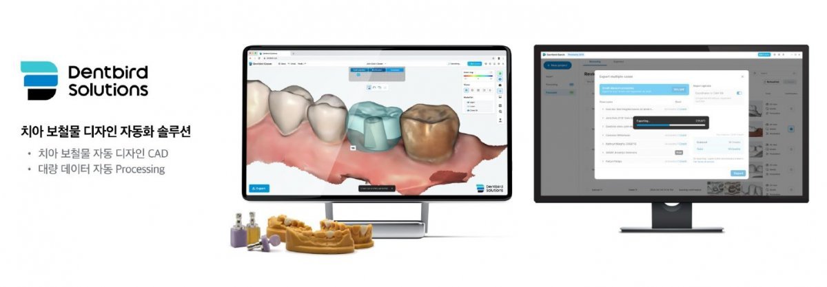 이마고웍스의 3D 치과 설계 소프트웨어 덴트버드 솔루션 / 출처=이마고웍스