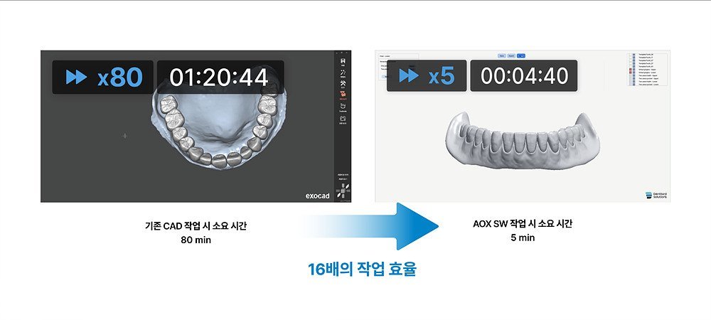 이마고웍스의 3D 치과 설계 소프트웨어 덴트버드 솔루션 / 출처=이마고웍스