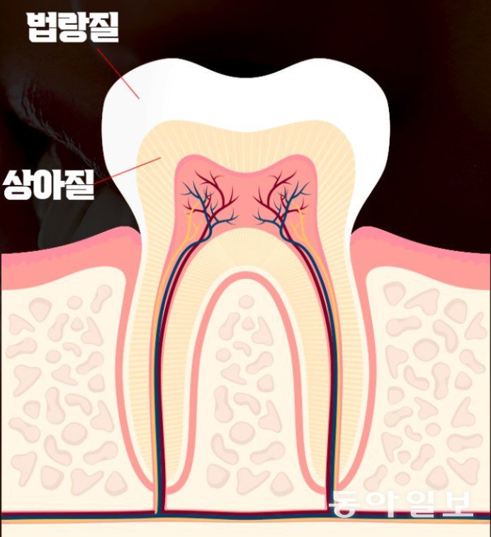 치아의 가장 겉 부분은 단단한 ‘법랑질’로 싸여있고 그 안엔 ‘상아질’이 있다. 동아일보DB