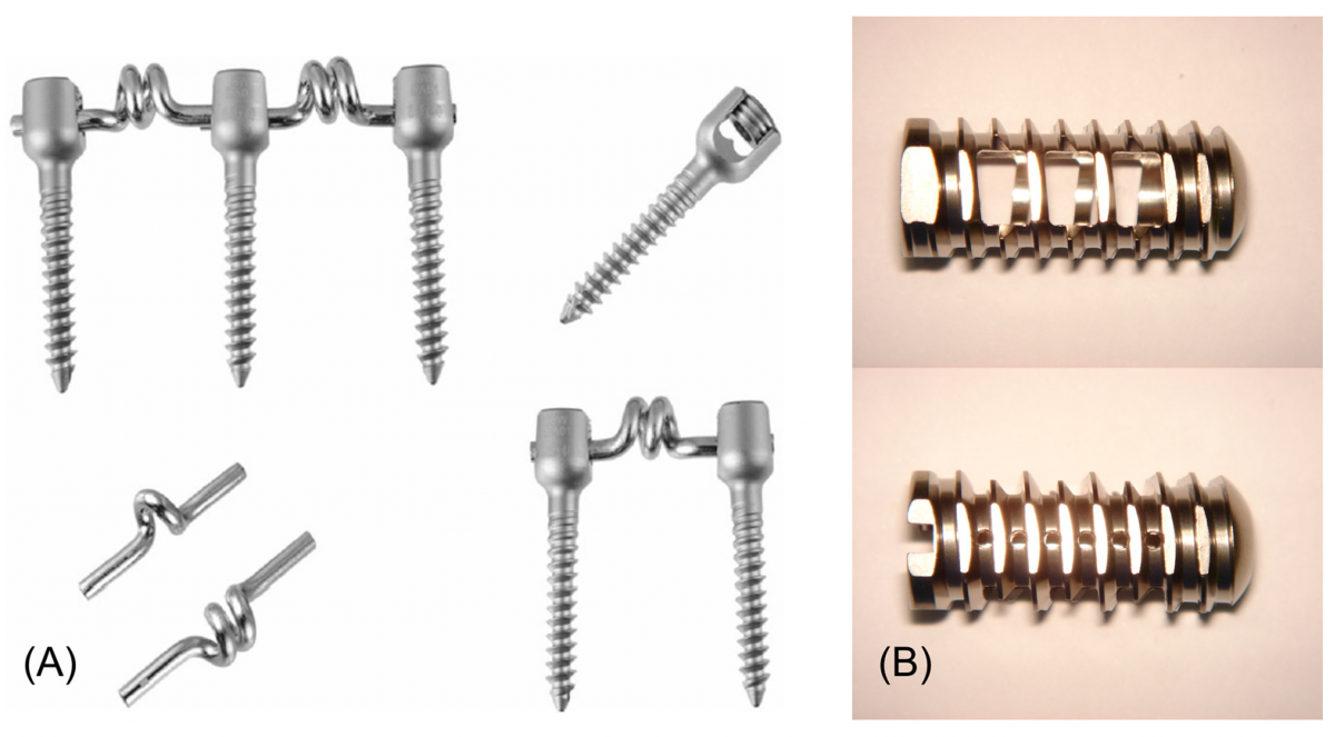 SCIE급 논문에 수록된 반강성고정술 관련 제품 사진. (A) 니티놀 스프링 로드와 2개의 홈을 지닌 스크루로 구성된 바이오플렉스, (B) 티타늄 합금으로 된 나사선의 원통형 케이지. 좌측 하단의 스프링 로드를 관찰하면 양쪽의 일자형 부위 중심과 가운데 코일부의 중심이 일직선에 있지 않고 편심 구조를 이룬다는 것을 알 수 있다.