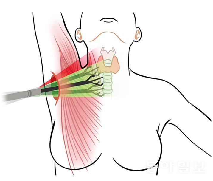 GOSTA로봇수술 | 고려대학교의료원 제공