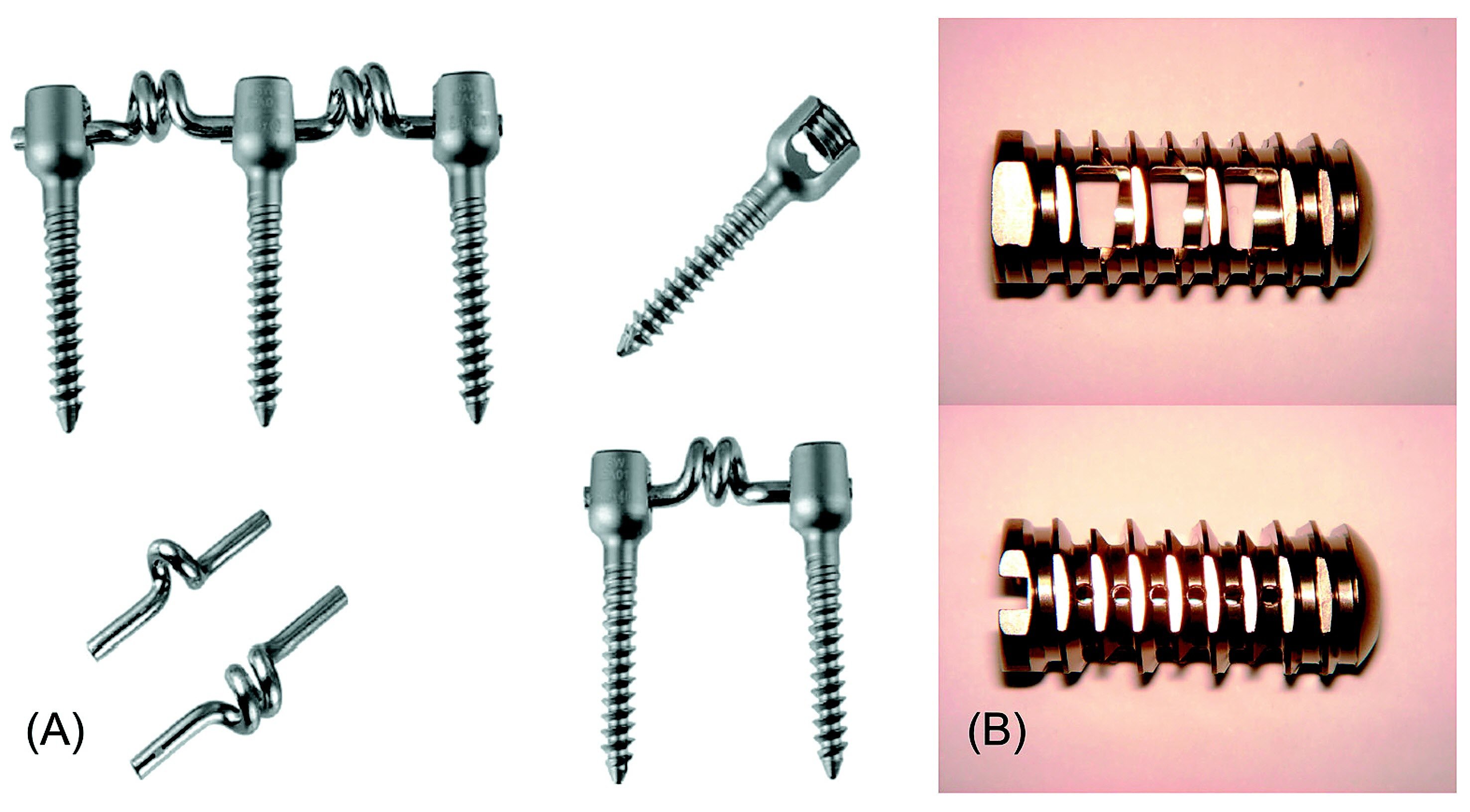 반강성고정술에 사용하는 (A) 바이오플렉스(니티놀 스프링 로드와 스크루), (B) 긴 나선의 원통형 케이지. 서울 광혜병원 제공