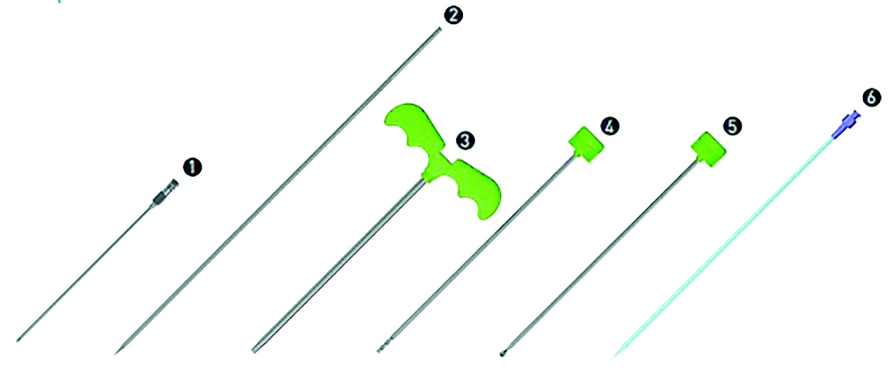 추간공확장술에 사용되는 특수 키트의 구성도. ①토이니들, ②트로카, ③캐뉼러, ④엔드밀, ⑤큐렛, ⑥카테터.