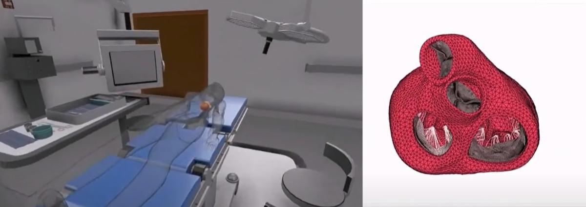 버추얼 트윈 기술로 수술실 환경과 장기를 가상 공간에 구현한 모습 / 출처=IT동아