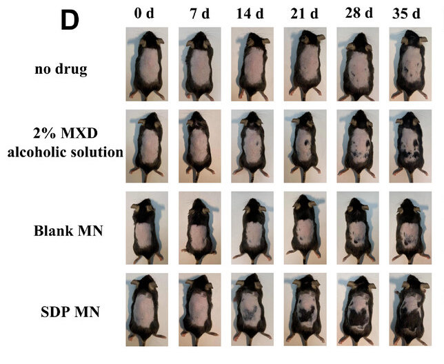 맨 윗줄부터 차례로
 1️⃣약물 미투여군,
2️⃣ 미녹시딜 2% 알코올 용액군,
3️⃣ 약물이 없는 마이크로니들 패치군,
4️⃣ 미녹시딜+스테비오사이드 마이크로니들 패치군.