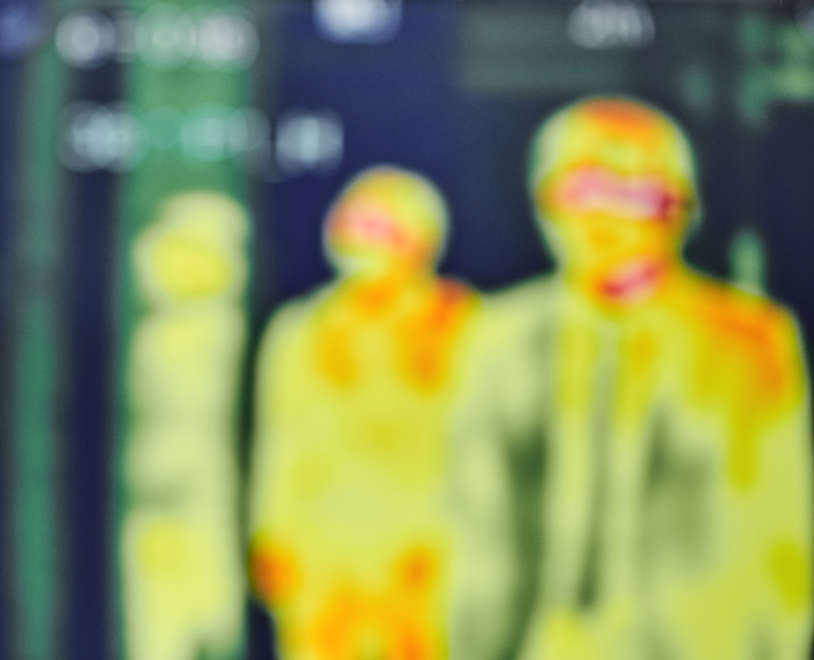 영국 연구진이 “스트레스를 받으면 코의 온도가 평균 3~6도 떨어진다”는 연구 결과를 발표했다. 코의 온도 회복 속도가 불안장애나 스트레스 내성의 지표가 될 수 있다는 분석도 나왔다. 사진=게티이미지 뱅크