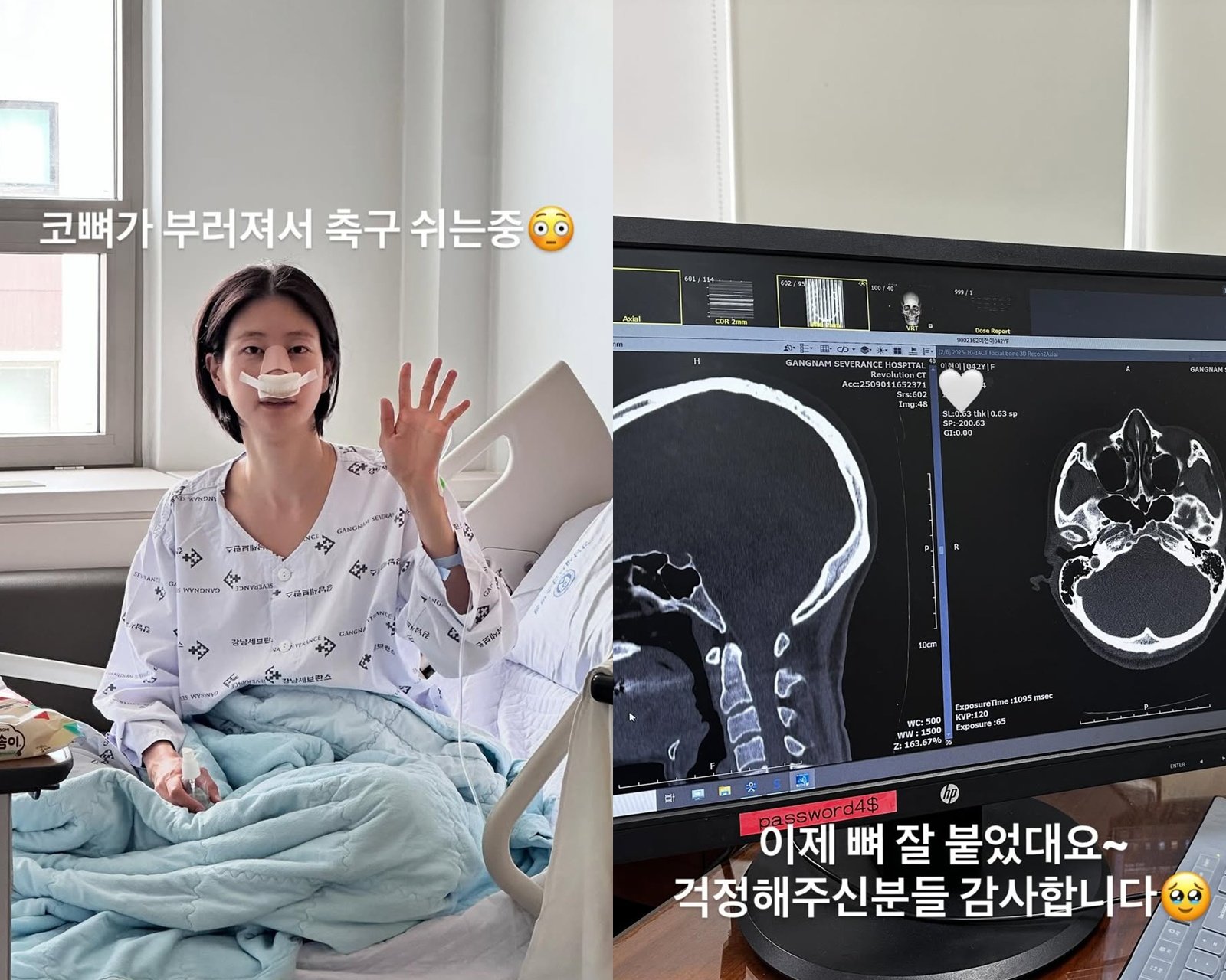 사진=이현이 SNS 캡처