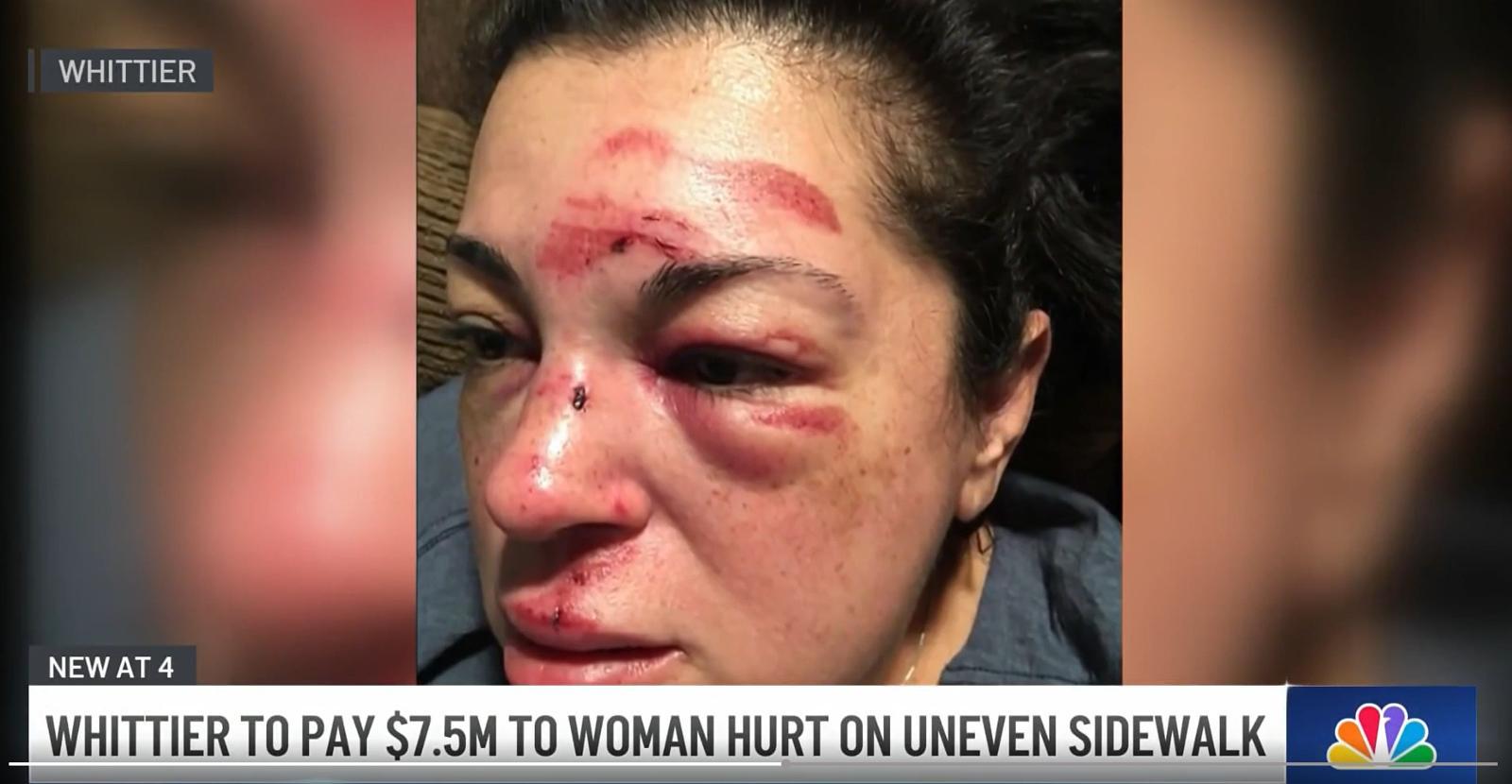 사고 당시 부상을 입은 저스틴 구롤라의 모습 출처=NBC 로스앤젤레스.