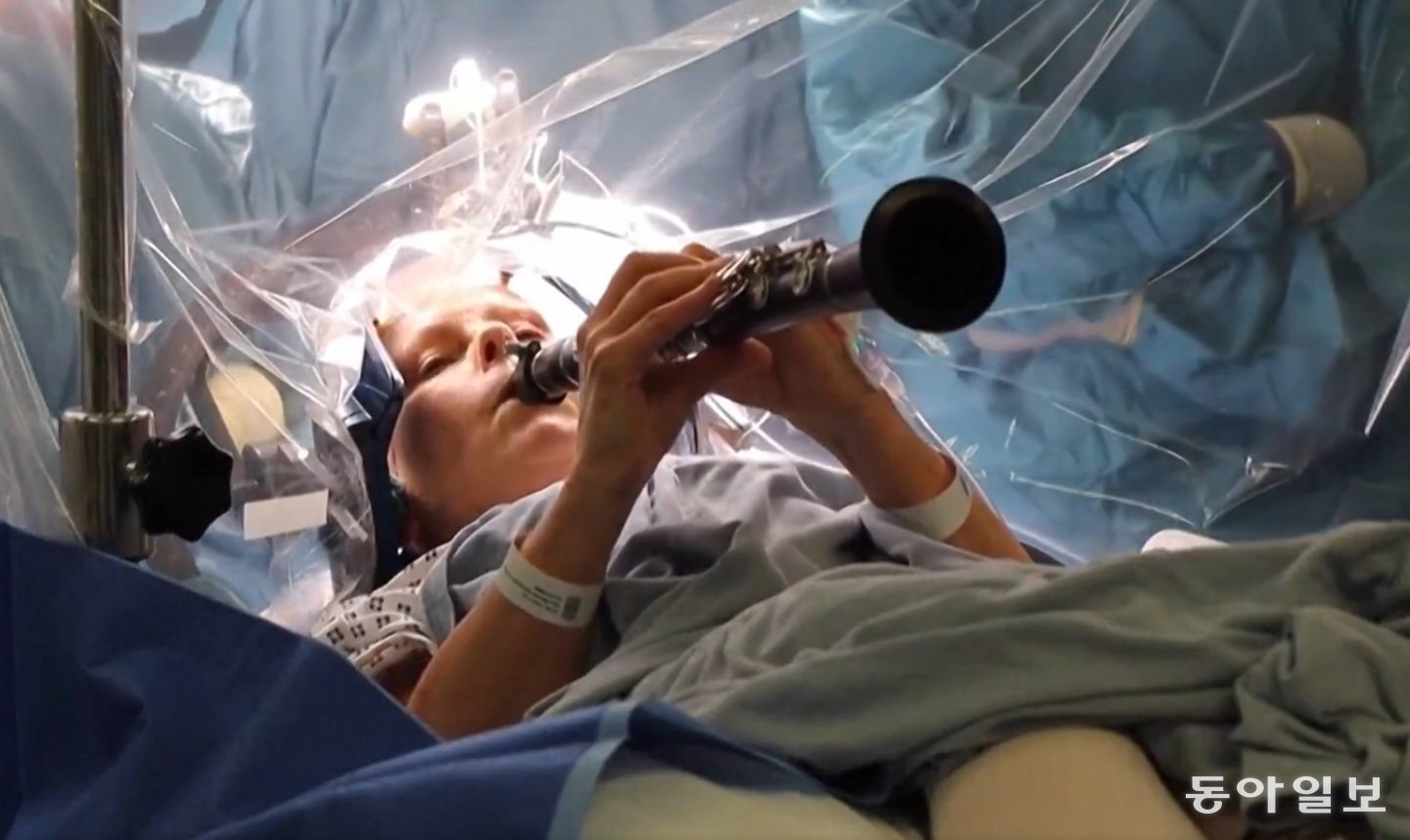 파키슨병 환자가 올해 7월 런던 킹스 칼리지 병원에서 뇌심부자극술을 받는 동안 클라리넷 연주를 하고 있다. X캡처