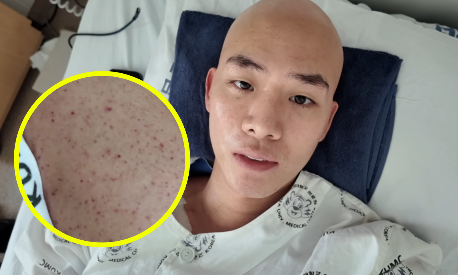 배우 차현승이 백혈병 투병 중 혈소판 감소로 인한 점상출혈을 겪고 있다고 전했다. 그는 퇴원 무산에도 운동과 명상으로 회복 의지를 보이며 “끝까지 이겨내겠다”고 말했다. 사진=유튜브 ‘차현승 ChaHyunSeung’