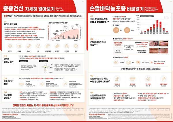 세계 건선의 날 맞아 중증 건선 및 손발바닥 농포증에 대한 인포그래픽 2종 제작·공개