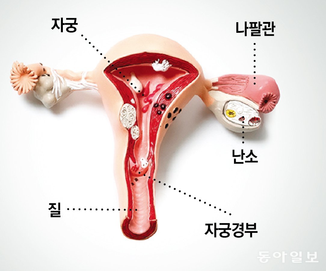 자궁과 난소의 위치. 사진 박해윤 기자