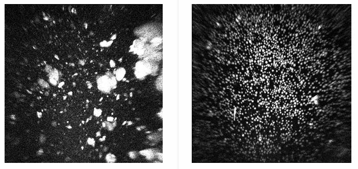미국 머크(MSD)가 국제우주정거장(ISS)에서 키트루다의 주요 단백질 결정화 실험을 진행한 결과 지구에서 만들어진 단백질 결정(왼쪽)은 비균일하고 점도가 높은 반면 우주 공간에서 생성된 단백질 결정(오른쪽)은 균일하고 점도가 낮았다. 네이처 미세중력
