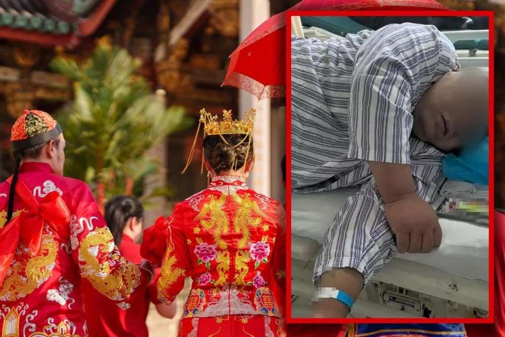 중국의 한 남성이 여자친구 부모님에게 좋은 인상을 남기고자 위 우회술을 받은 뒤 사망했다. SCMP 캡처