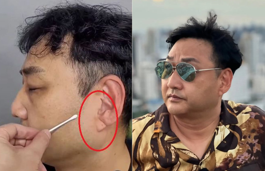 개그맨 김수용(59)이 유튜브 촬영 중에 의식을 잃고 쓰러졌다는 소식이 전해지면서, 그의 귓불에 있던 대각선 모양 주름에 시선이 쏠리고 있다. (김수용 인스타그램)