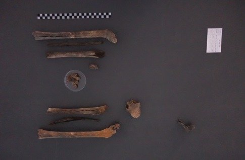 2024년 11월 대구광역시 군위군에서 발굴된 고(故) 구자길 일병의 유해. 국유단 제공