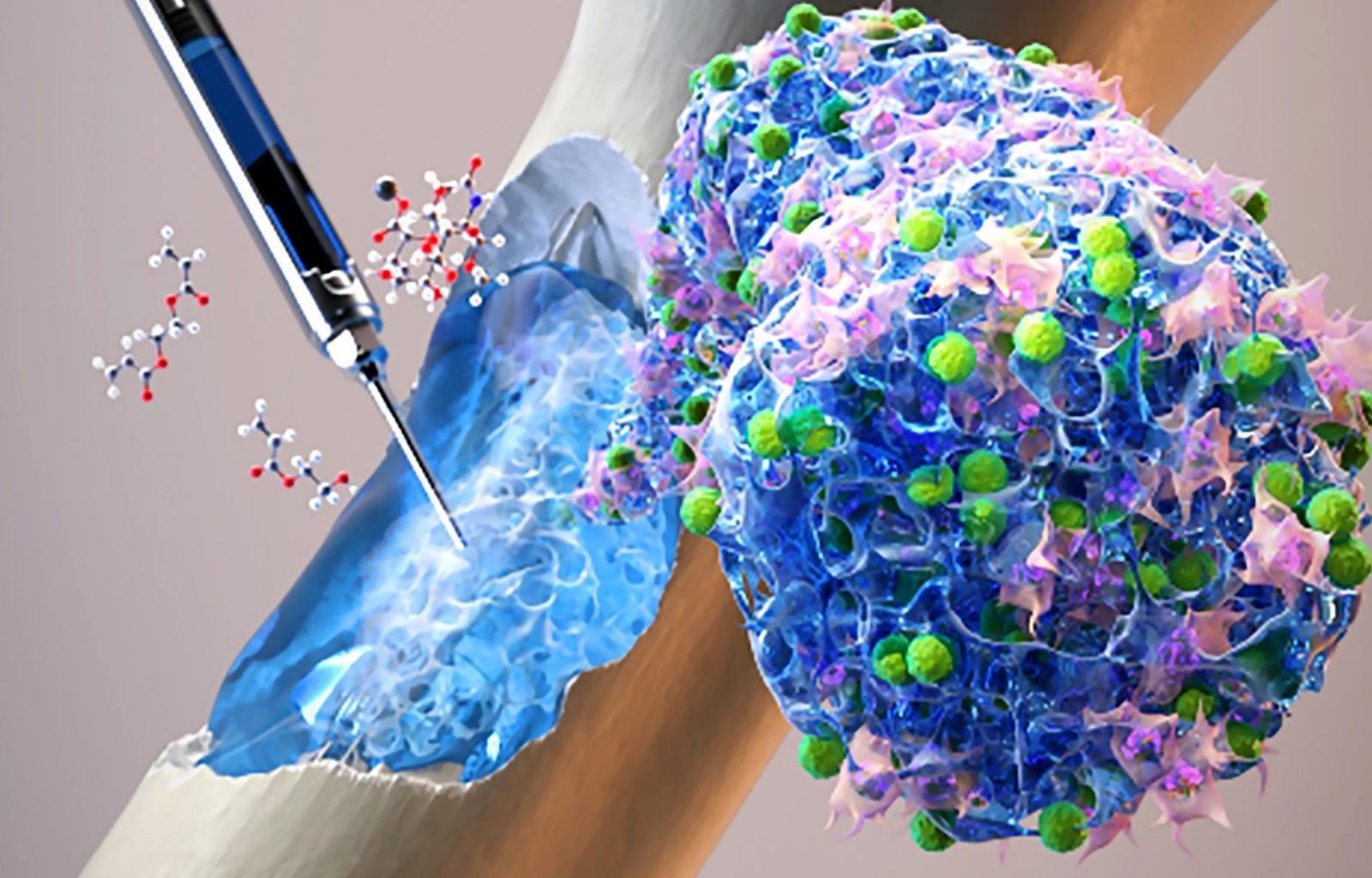 매트릭셀바이오는 바이오젤 관련 전 공정을 아우르는 장비를 모두 설계했다 / 출처=매트릭셀바이오