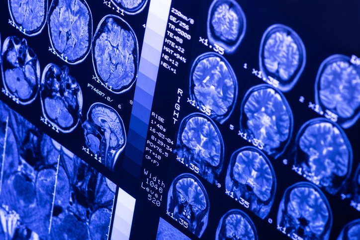 사진=게티이미지코리아.