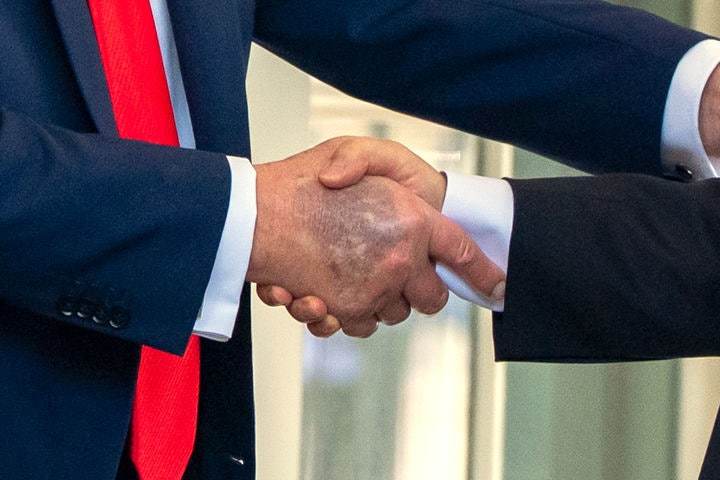 25일(현지 시간) 미국 워싱턴 백악관에서 이재명 대통령과 악수한 도널드 트럼프 미국 대통령 손등에 푸른색 멍이 크게 들어 있다. 2025.08.26 워싱턴=AP/뉴시스