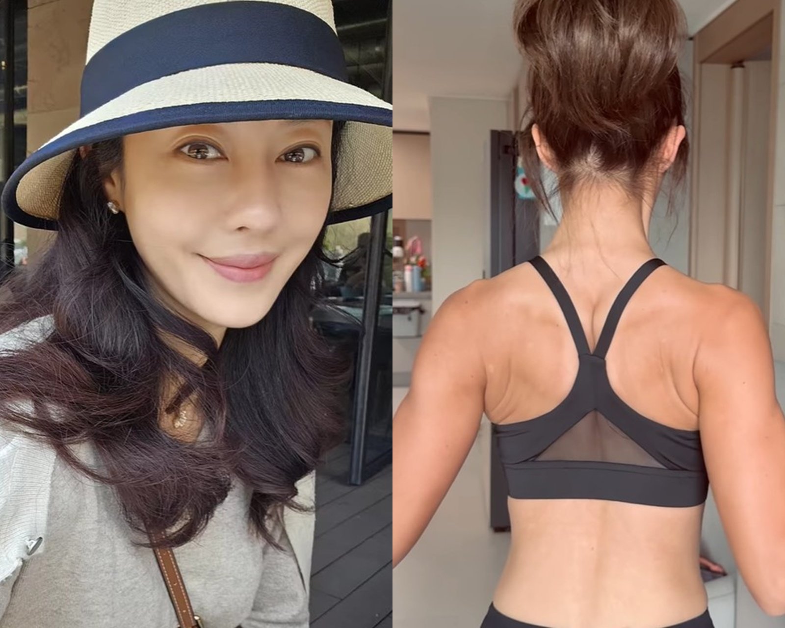 쥬얼리 출신 이지현이 백반증 진단 사실을 밝히며 치료 과정과 심경을 전했다. 사진=이지현 SNS 캡처