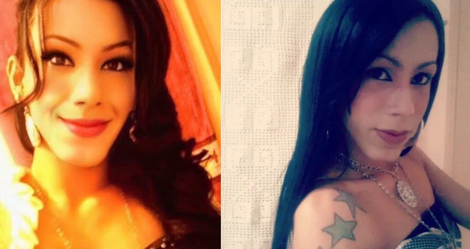 불법 시술 받기 전 줄리아나 올리베이라. 출처=인스타그램